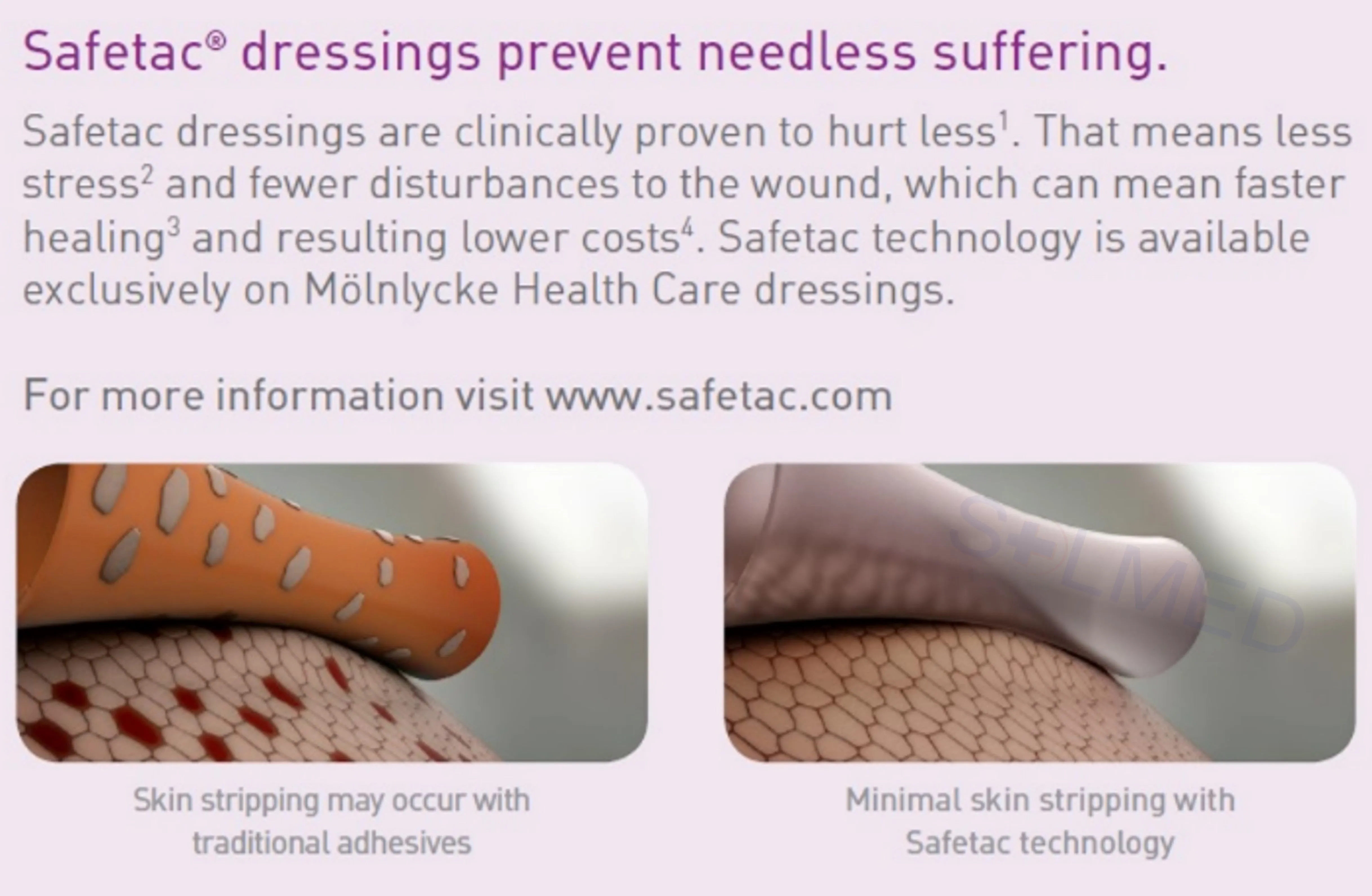 Mepilex Border Flex Foam Dressing