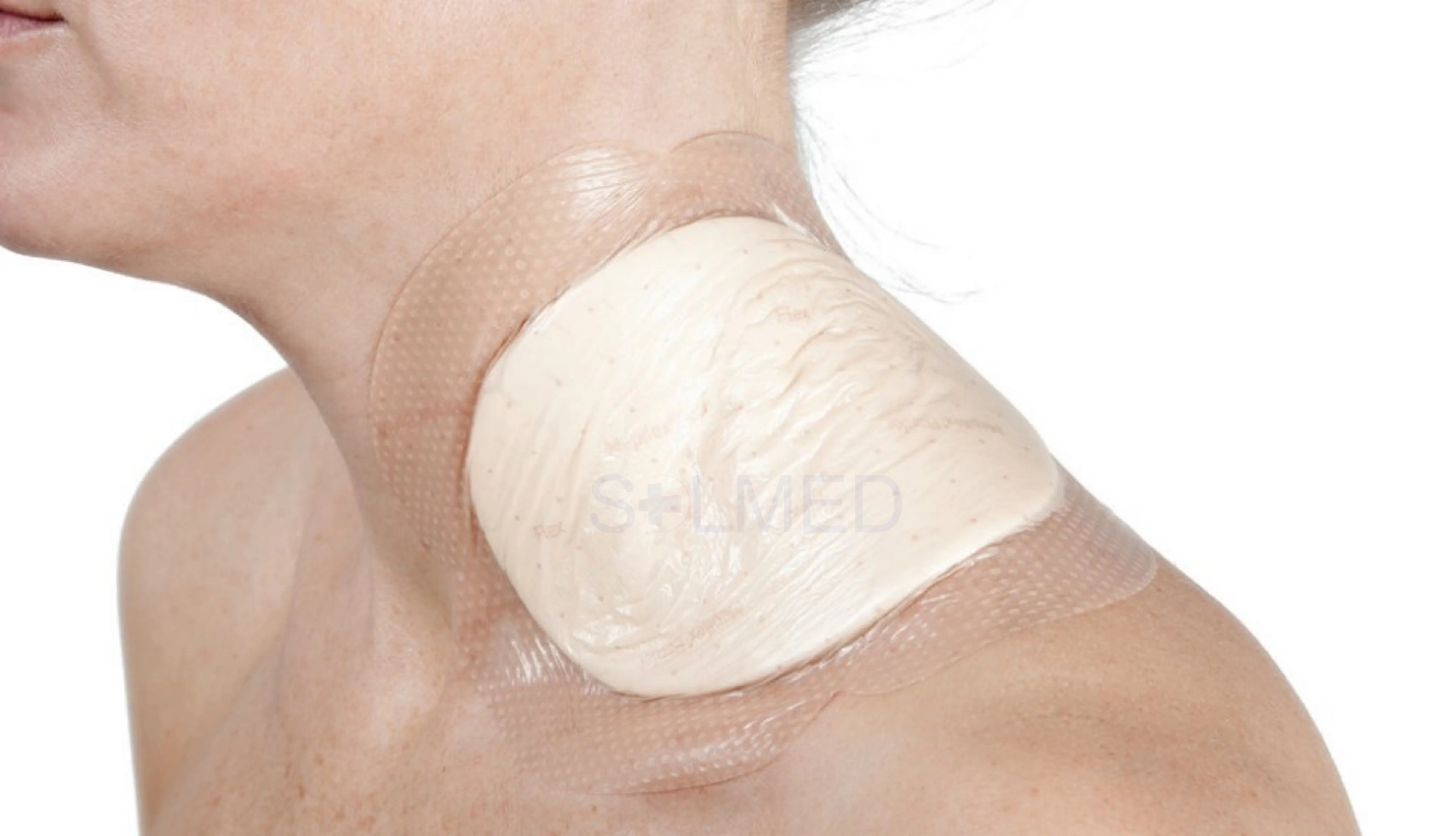 Mepilex Border Flex Foam Dressing